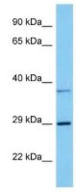 GPR146 Rabbit anti-Mouse, Polyclonal, Novus Biologicals:Antibodies:Primary